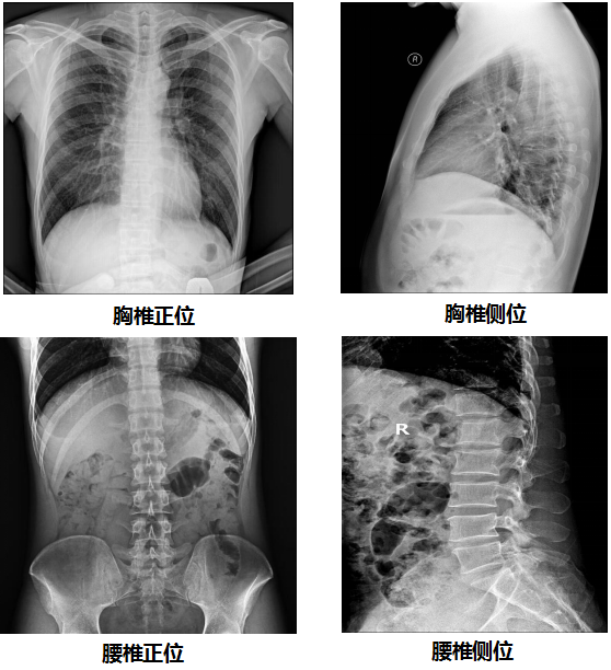 PLD7300系列雙立柱DR臨床圖像