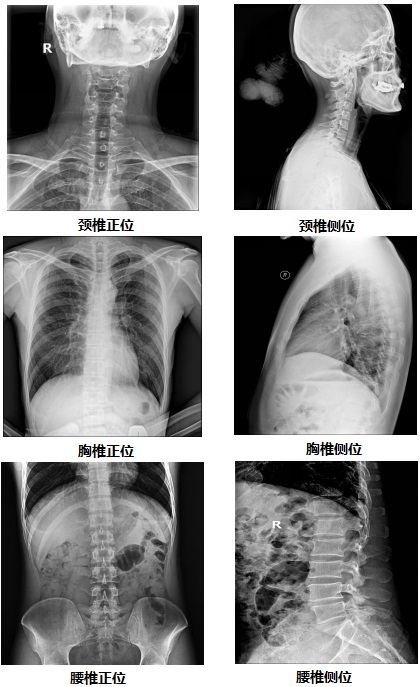 固定懸吊dr-PLD7800E部分臨床效果圖