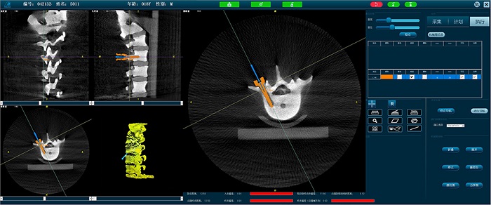 PL300B脊柱外科手術導航定位系統-操作界面